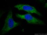 RC3H1 Antibody in Immunocytochemistry (ICC/IF)