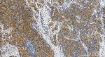 RC3H1 Antibody in Immunohistochemistry (Paraffin) (IHC (P))
