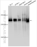 CD45 Antibody in Western Blot (WB)