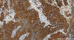 IGFBP2 Antibody in Immunohistochemistry (Paraffin) (IHC (P))
