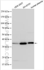 IGFBP2 Antibody in Western Blot (WB)