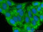 AFP Antibody in Immunocytochemistry (ICC/IF)