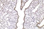 DNAH11 Antibody in Immunohistochemistry (Paraffin) (IHC (P))