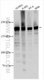 FBXO38 Antibody in Western Blot (WB)