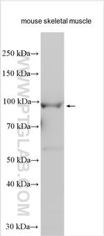 RASA4B Antibody in Western Blot (WB)