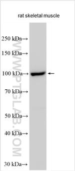 RASA4B Antibody in Western Blot (WB)