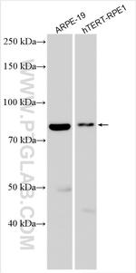 SLC24A2 Antibody in Western Blot (WB)