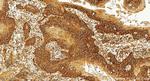 Tyrosinase Antibody in Immunohistochemistry (Paraffin) (IHC (P))