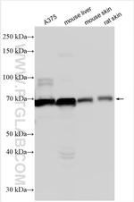Tyrosinase Antibody in Western Blot (WB)