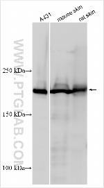 PPL Antibody in Western Blot (WB)
