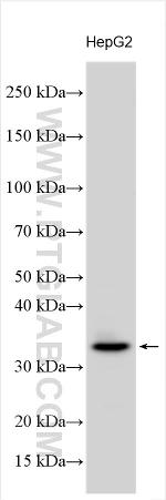 CDC42BPA Antibody in Western Blot (WB)