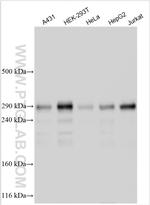 ZNF638 Antibody in Western Blot (WB)