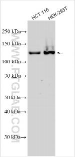 DIAPH2 Antibody in Western Blot (WB)
