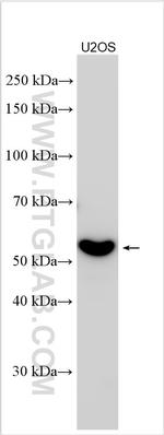 KIAA1715 Antibody in Western Blot (WB)
