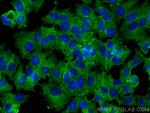 Pan-cadherin Antibody in Immunocytochemistry (ICC/IF)