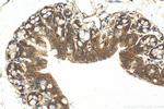 Pan-cadherin Antibody in Immunohistochemistry (Paraffin) (IHC (P))