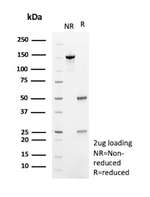 HLA-E (Major histocompatibility complex, class I, E) Antibody in SDS-PAGE (SDS-PAGE)