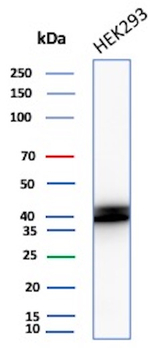 HLA-E (Major histocompatibility complex, class I, E) Antibody in Western Blot (WB)