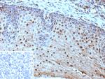 HLA-E (Major histocompatibility complex, class I, E) Monoclonal Antibody (HLAE/9468)