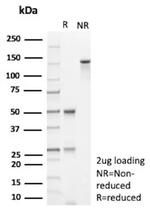 HLA-E (Major histocompatibility complex, class I, E) Antibody in SDS-PAGE (SDS-PAGE)