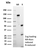 HLA-E (Major histocompatibility complex, class I, E) Antibody in SDS-PAGE (SDS-PAGE)