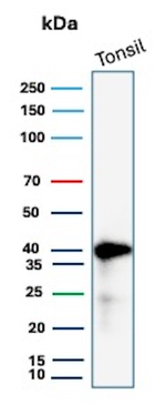 HLA-E (Major histocompatibility complex, class I, E) Monoclonal Antibody (HLAE/13125)