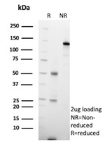 HLA-E (Major histocompatibility complex, class I, E) Antibody in SDS-PAGE (SDS-PAGE)