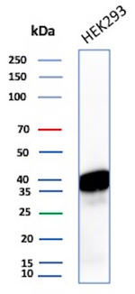 HLA-E (Major histocompatibility complex, class I, E) Antibody in Western Blot (WB)