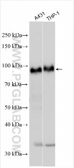 CD117/c-Kit Antibody in Western Blot (WB)