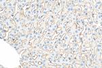 ASGR1 Antibody in Immunohistochemistry (Paraffin) (IHC (P))