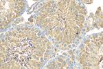 CFAP70 Antibody in Immunohistochemistry (Paraffin) (IHC (P))