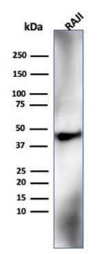 HLA-G (Major Histocompatibility Complex, class I, G) Antibody in Western Blot (WB)