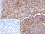 HLA-G (Major Histocompatibility Complex, class I, G) Monoclonal Antibody (HLAG/7094)