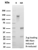 HLA-G (Major Histocompatibility Complex, class I, G) Antibody in SDS-PAGE (SDS-PAGE)