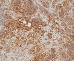 HLA-G (Major Histocompatibility Complex, class I, G) Antibody in Immunohistochemistry (Paraffin) (IHC (P))