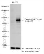 Phospho-FRS2 (Tyr436) Antibody in Western Blot (WB)