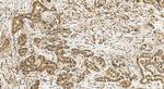 DFNA5/GSDME Antibody in Immunohistochemistry (Paraffin) (IHC (P))