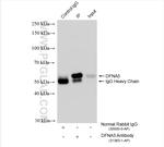 DFNA5/GSDME Antibody in Immunoprecipitation (IP)