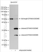 DFNA5/GSDME Antibody in Western Blot (WB)