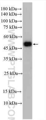 DFNA5/GSDME Antibody in Western Blot (WB)