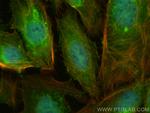 PSMA5 Antibody in Immunocytochemistry (ICC/IF)