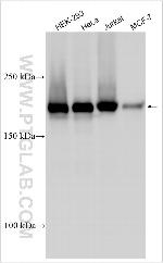 HOXB8 Antibody in Western Blot (WB)