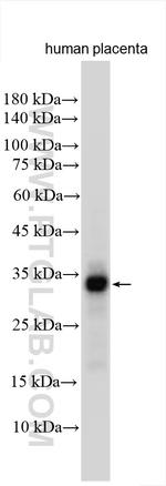 SBSPON Antibody in Western Blot (WB)