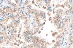 Cathepsin B Antibody in Immunohistochemistry (Paraffin) (IHC (P))