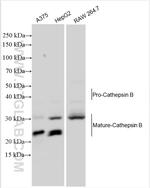 Cathepsin B Antibody in Western Blot (WB)