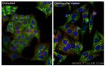 P62, SQSTM1 Antibody in Immunocytochemistry (ICC/IF)