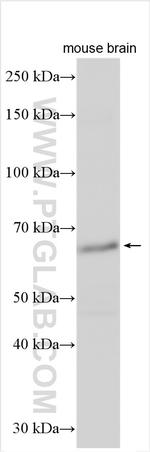 P62, SQSTM1 Antibody in Western Blot (WB)
