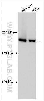 PDCD11 Antibody in Western Blot (WB)