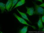 TUSC1 Antibody in Immunocytochemistry (ICC/IF)