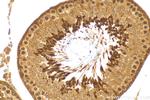 TUSC1 Antibody in Immunohistochemistry (Paraffin) (IHC (P))